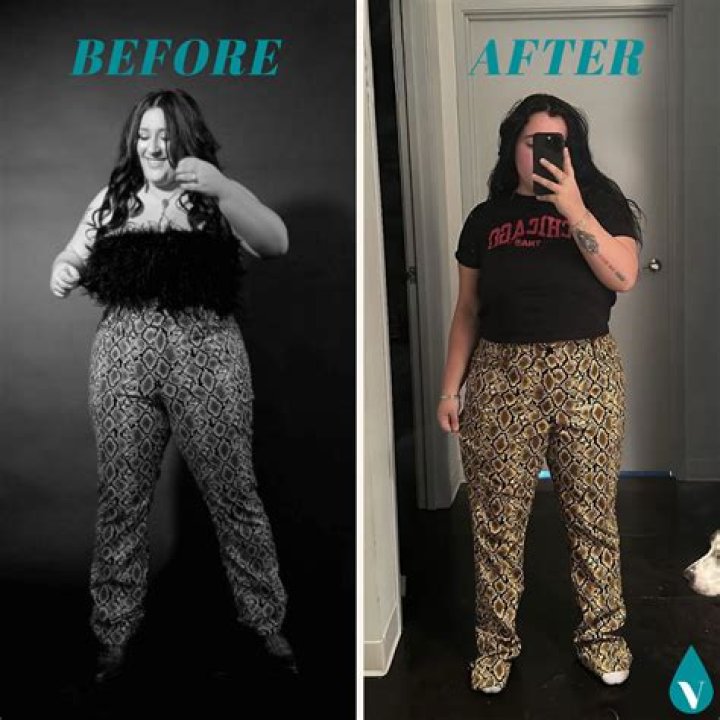 
Gemma Collins Weight Loss Before And After: How Did She Lose Her Weight? Illness And Health Update 